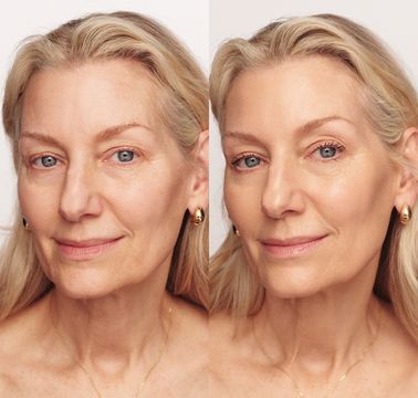 Barvena Foundation™ – For an even and natural skin tone