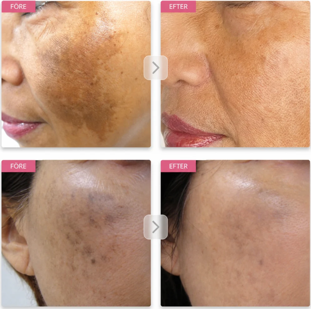 Pigment Balance – Face cream for more even skin tone