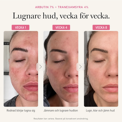 Pigment Balance – Face cream for more even skin tone