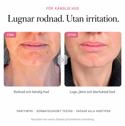 Pigment Balance – Face cream for more even skin tone