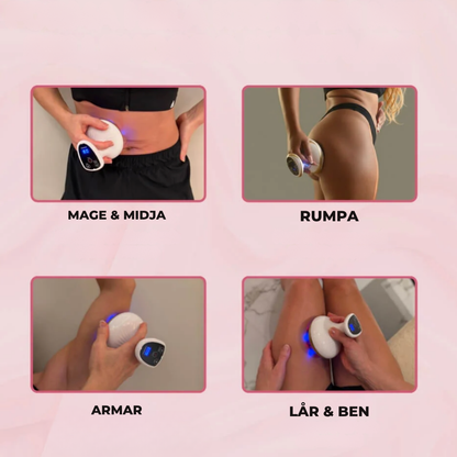 Electric Cupping Massage™