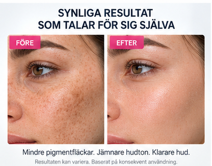 Pigment Balance – Face cream for more even skin tone
